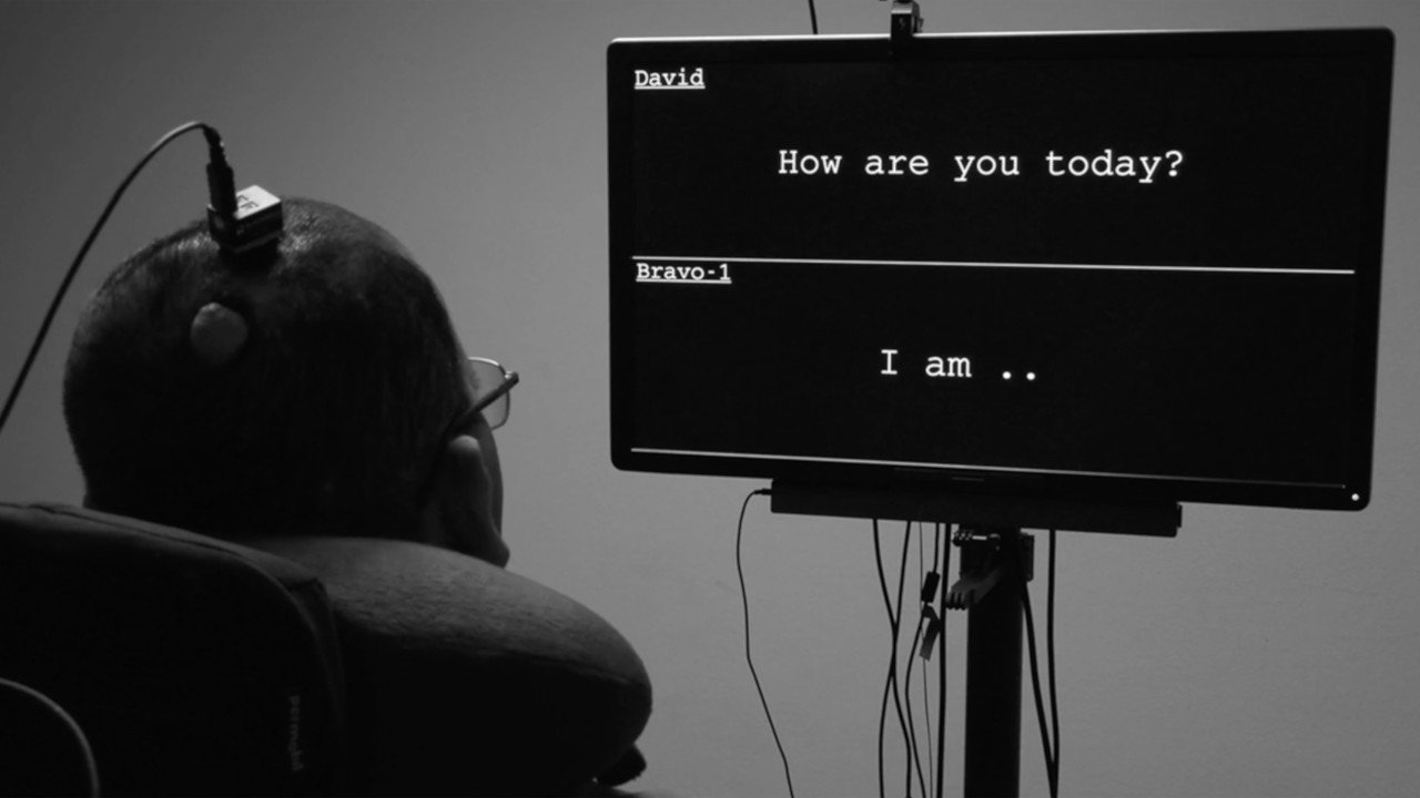 Neural-Prosthesis-Response