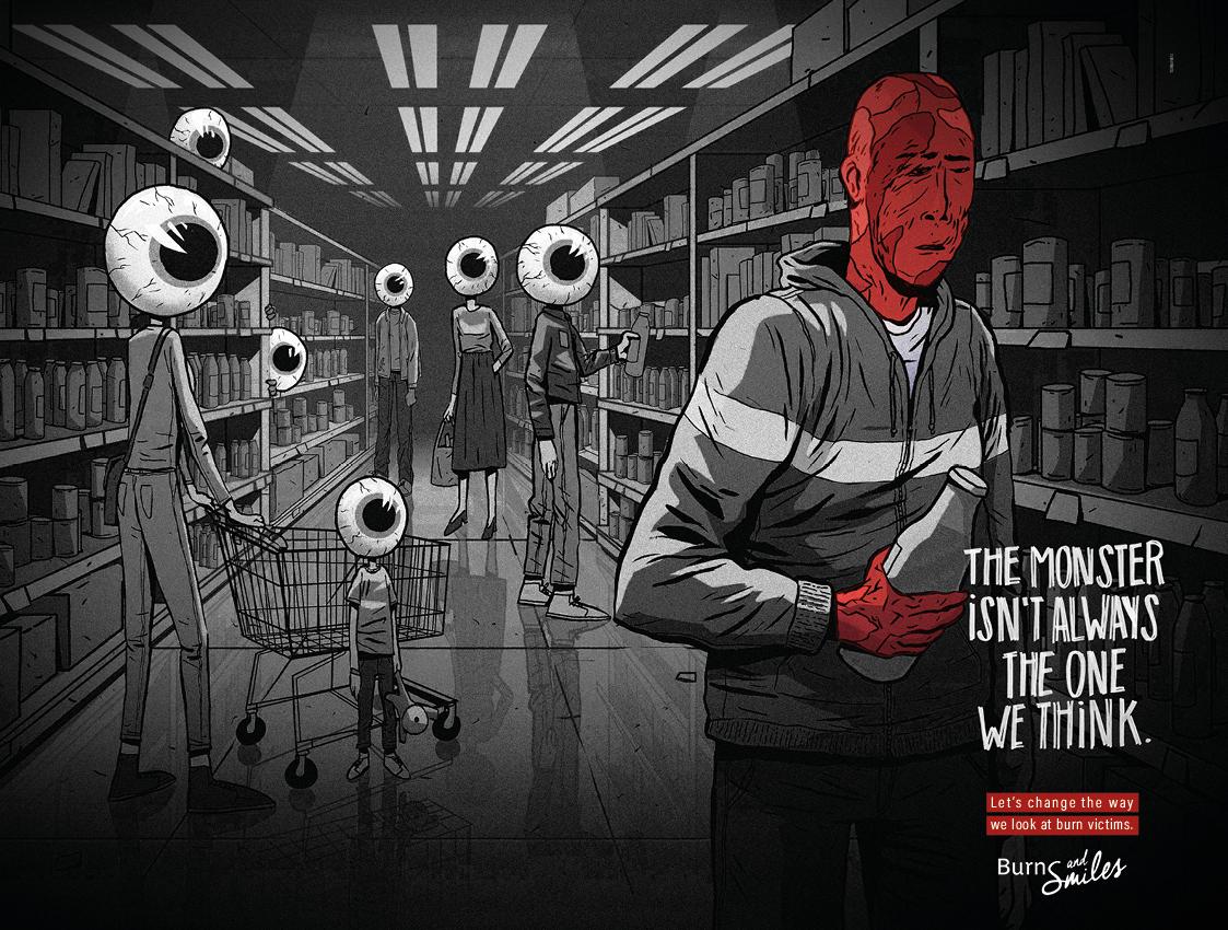 Burns & Smiles Print Ad - The monster isn’t always the one we think.