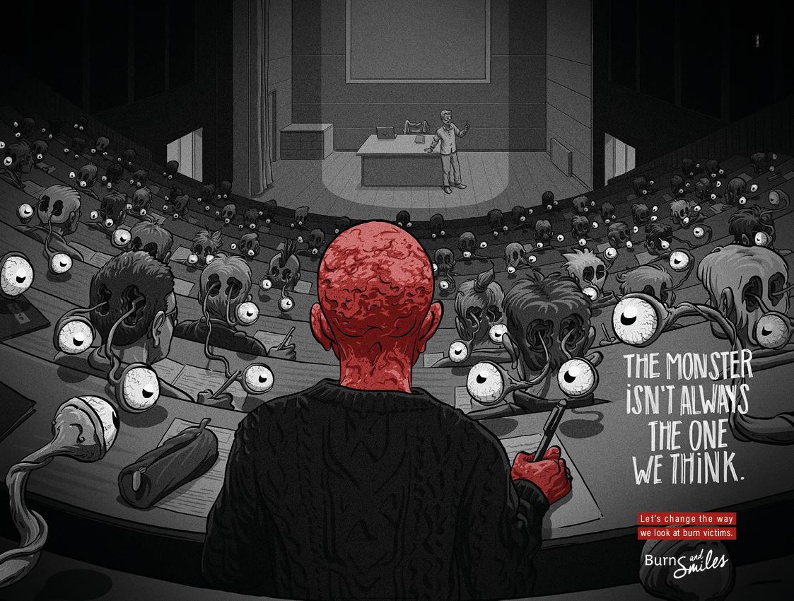 Burns & Smiles Print Ad - The monster isn’t always the one we think.